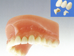 歯周病治療は新宿区新宿の歯医者松田歯科医院ハイブリットセラミック